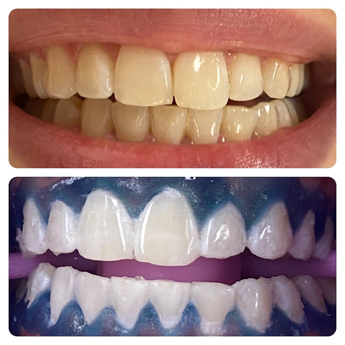 institut beauty smile - 5